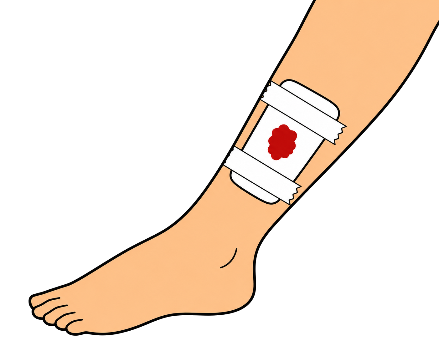 Injury card: lower leg with a taped gauze dressing showing a red patch